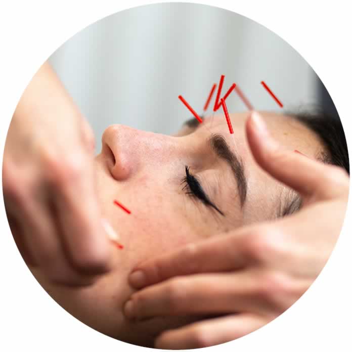 acupuncture for skin health