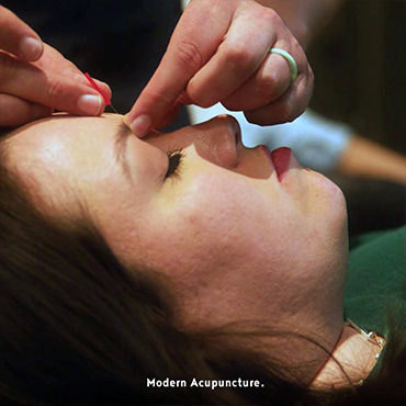 Acupuncture Image - 