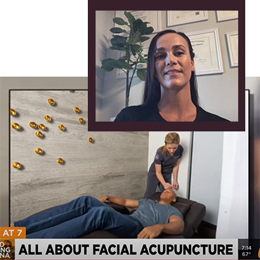 Acupuncture Image - 